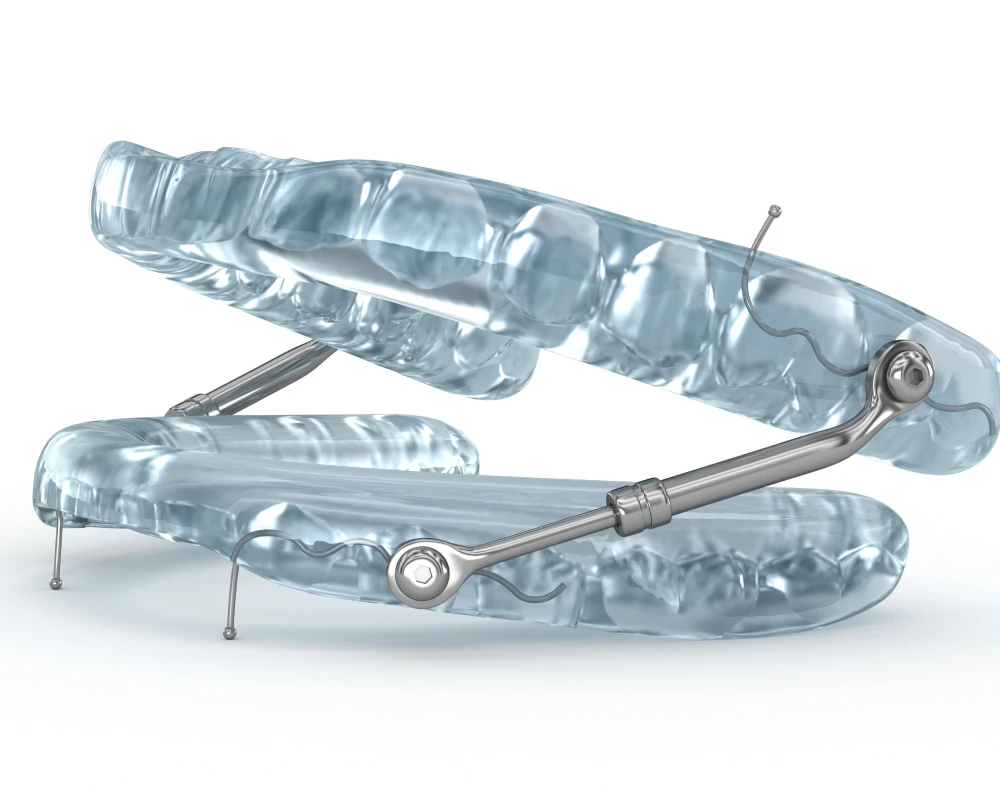 Orthodontiste adolescent Vourles Lille