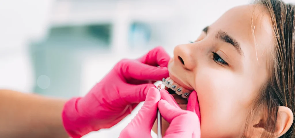 Orthodontie adolescent à Vourles, près de Lyon