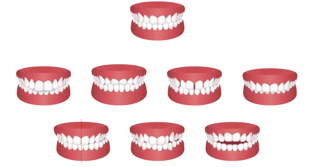 Orthodontiste Vourles Dr Kelly TILLY