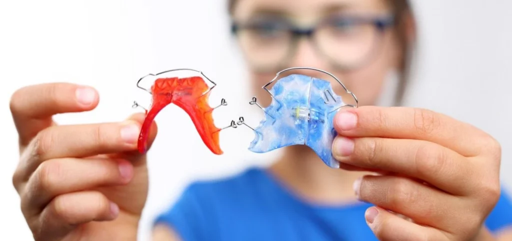 Le rôle de l’interception en orthodontie